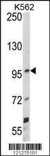 Anti-UNC5C Rabbit Polyclonal Antibody