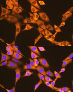 Immunofluorescence analysis of NIH-3T3 cells using Anti-FAT10 Antibody [ARC1379] (A306378) at a dilution of 1:100 (40x lens). DAPI was used to stain the cell nuclei (blue).