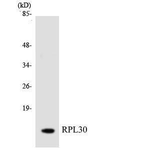 Anti-RPL30 Rabbit Polyclonal Antibody