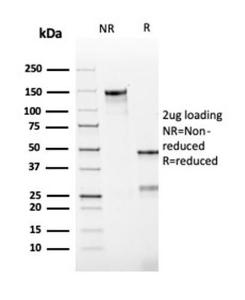 SDS-PAGE analysis of Anti-Bcl-2 Antibody [rBCL2/782] under non-reduced and reduced conditions; showing intact IgG and intact heavy and light chains, respectively. SDS-PAGE analysis confirms the integrity and purity of the antibody.