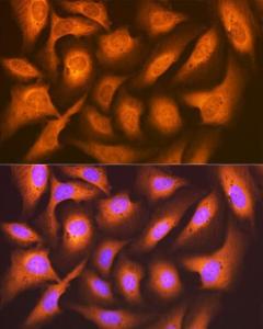 Immunofluorescence analysis of U-2 OS cells using Anti-FAT10 Antibody [ARC1379] (A306378) at a dilution of 1:100 (40x lens). DAPI was used to stain the cell nuclei (blue).