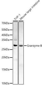 Western blot analysis of various lysates, using Anti-Granzyme B Antibody (A11541) at 1:1,000 dilution