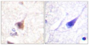 Immunohistochemical analysis of paraffin-embedded human brain using Anti-CaMK4 (phospho Thr196 + Thr200) Antibody. The right hand panel represents a negative control, where the antibody was pre-incubated with the immunising peptide