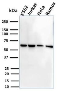 Western blot analysis of human K562, Jurkat, HeLa, and Ramos cell lysates using Anti-CD127 Antibody [IL7R/2751]