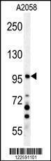 Anti-NPAS2 Rabbit Polyclonal Antibody (Biotin)