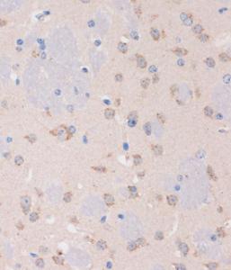 Immunohistochemistry analysis of paraffin-embedded mouse brain using Anti-STIM2 Antibody (A305495) at a dilution of 1:100 (40X lens). Perform microwave antigen retrieval with 10 mM PBS buffer pH 7.2 before commencing with IHC staining protocol