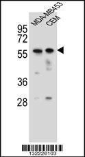 Anti-FOXD4 Rabbit Polyclonal Antibody (APC (Allophycocyanin))