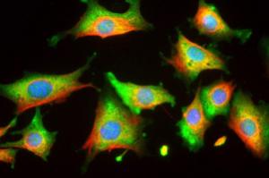 NIH/3T3 cells stained with Anti-Enolase 1 Antibody (green), Anti-Vimentin Antibody (A85421/red) and DNA (blue). The Anti-Enolase 1 Antibody reveals strong cytoplasmic staining, while the Anti-Vimentin Antibody reveals cytoplasmic intermediate filaments