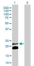 Anti-IFNB1 Rabbit Polyclonal Antibody