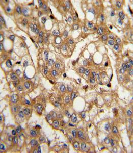 Anti-Interferon beta Rabbit Polyclonal Antibody