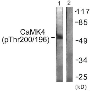 Western blot analysis of lysates from K562 cells treated with H2O2 100uM 30' using Anti-CaMK4 (phospho Thr196 + Thr200) Antibody. The right hand lane represents a negative control, where the antibody is blocked by the immunising peptide