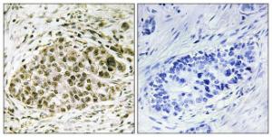 Antibody anti-LYL-1 100 µg