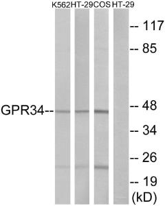 Western blot analysis of lysates from HT-29, K56 and COS7 cells using Anti-GPR34 Antibody. The right hand lane represents a negative control, where the antibody is blocked by the immunising peptide