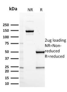 SDS-PAGE analysis of Anti-CD127 Antibody [IL7R/2751] under non-reduced and reduced conditions; showing intact IgG and intact heavy and light chains, respectively. SDS-PAGE analysis confirms the integrity and purity of the antibody