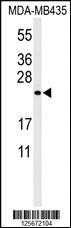 Anti-ZCCHC24 Rabbit Polyclonal Antibody