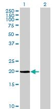 Anti-IFNG Mouse Polyclonal Antibody