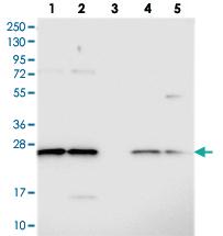 Anti-C14ORF166 Rabbit Polyclonal Antibody