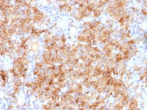 Immunohistochemical analysis of formalin-fixed, paraffin-embedded human parathyroid using Anti-Chromogranin A Antibody