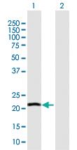 Anti-IFNG Mouse Polyclonal Antibody