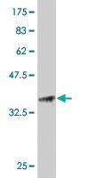 Anti-FGF21 Mouse Monoclonal Antibody [clone: 3A6]