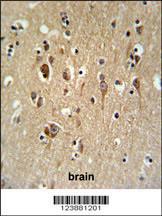 Anti-FA2H Rabbit Polyclonal Antibody (APC (Allophycocyanin))