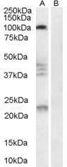 Antibody anti-RTN4R 100 µg