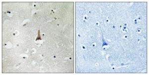 Immunohistochemical analysis of paraffin-embedded human brain tissue using Anti-LRP10 Antibody The right hand panel represents a negative control, where the antibody was pre-incubated with the immunising peptide