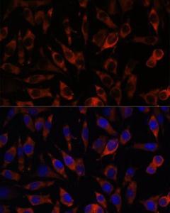 Immunofluorescence analysis of L929 cells using Anti-STIM2 Antibody (A305495) at a dilution of 1:100. DAPI was used to stain the cell nuclei (blue)