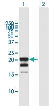 Anti-IFNG Mouse Polyclonal Antibody