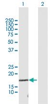 Anti-TCEAL1 Rabbit Polyclonal Antibody