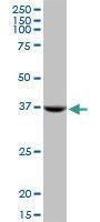 Anti-STX18 Mouse Monoclonal Antibody [clone: 200000]