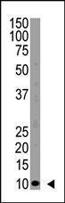 Anti-UB Rabbit Polyclonal Antibody