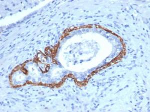 Immunohistochemical analysis of formalin-fixed, paraffin-embedded human prostate tissue using Anti-Cytokeratin 14 Antibody [KRT14/4129]