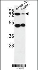 Anti-AVL9 Rabbit Polyclonal Antibody