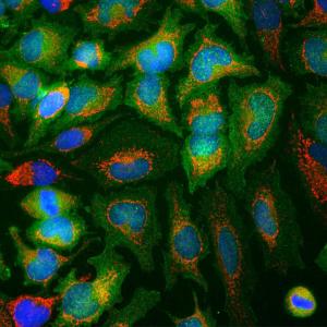 Immunofluorescent analysis of HeLa cells stained with Anti-Enolase 1 Antibody [253] (A85406), at a dilution of 1:500, in green, and co-stained with Anti-Heat Shock Protein 60 Antibody (A85438), at a dilution of 1:5000, in red.