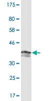 Anti-PDE5A Mouse Monoclonal Antibody [clone: 1F11]