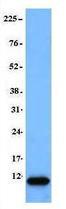 Anti-Ubiquitin Mouse Monoclonal Antibody [clone: P4D1]