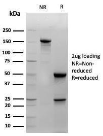 SDS-PAGE analysis of Anti-Cytokeratin 14 Antibody [KRT14/4129] under non-reduced and reduced conditions; showing intact IgG and intact heavy and light chains, respectively. SDS-PAGE analysis confirms the integrity and purity of the antibody