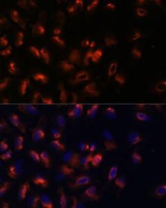 Immunofluorescence analysis of U-2 OS cells using Anti-STIM2 Antibody (A305495) at a dilution of 1:100. DAPI was used to stain the cell nuclei (blue)