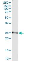 Anti-TCEAL1 Rabbit Polyclonal Antibody