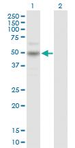 Anti-CARD8 Rabbit Polyclonal Antibody