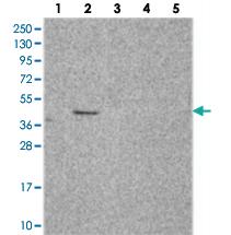 Anti-C2ORF69 Rabbit Polyclonal Antibody