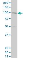 Anti-CPSF2 Mouse Polyclonal Antibody