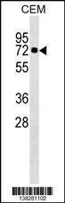 Anti-KLHL28 Rabbit Polyclonal Antibody (FITC (Fluorescein Isothiocyanate))