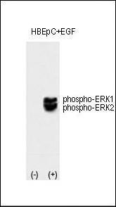 Anti-MAPK3 Rabbit Polyclonal Antibody (HRP (Horseradish Peroxidase))