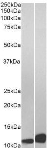 Anti-MIF Antibody (A84089) (001 µg/ml) staining of Daudi (A) and Jurkat (B) lysate (35 µg protein in RIPA buffer) Detected by chemiluminescence