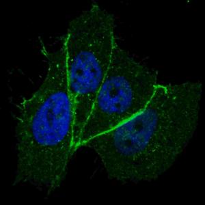 Anti-ERBB2 Rabbit Polyclonal Antibody (APC (Allophycocyanin))