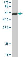 Anti-CNN1 Mouse Monoclonal Antibody [clone: 3C7-2A6]