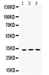 Anti-SOD3 Rabbit Polyclonal Antibody