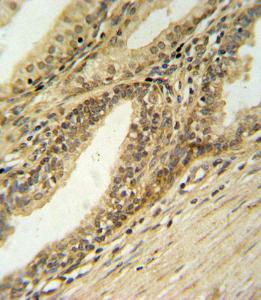 Anti-DFFB Rabbit Polyclonal Antibody (PE (Phycoerythrin))